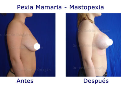 pexia-mamaria-1