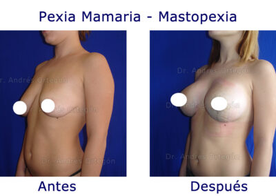 pexia-mamaria-2